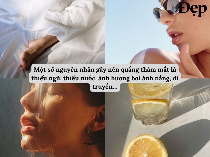 nguyen-nhan-gay-nen-quang-tham-mat