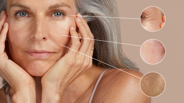 Làm thế nào để chăm sóc da khô do lão hóa?