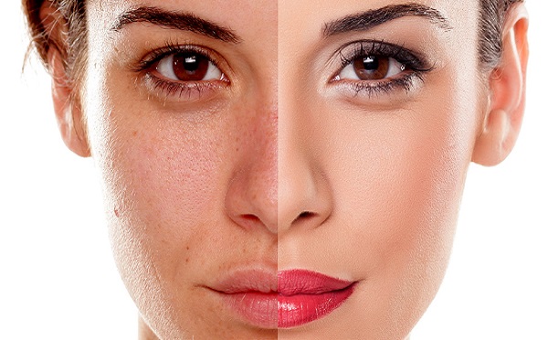 Cách làm đẹp da mặt cho làn da khô sạm và bị lão hóa